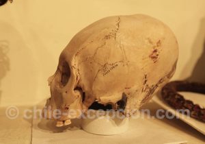 Musée Régional d'Iquique Déformations craniennes