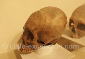 Musée Régional d'Iquique Déformations craniennes